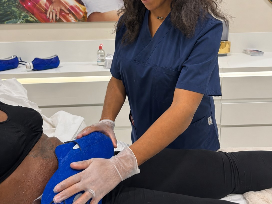 Applicateur de cryolipolyse maintenu sur l’abdomen pendant la séance