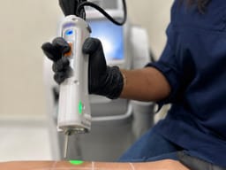 Séance de laser sur l’avant-bras, la grille de repérage tracée sur la peau