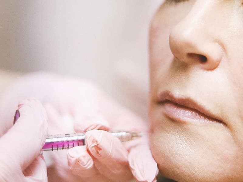 Facial injection performed with a fine syringe