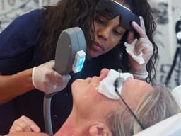 Applicateur de lumière pulsée passé sur le visage, coques de protection oculaire en place