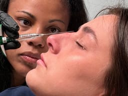 La Dr Cingala injectant l'acide hyaluronique le long du dos du nez, la patiente de profil